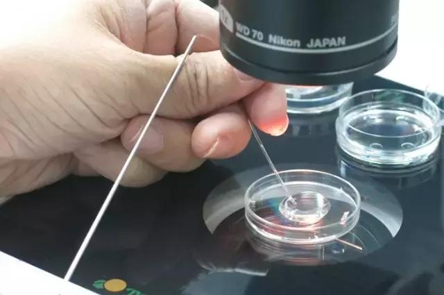 太神奇！生殖医学博士揭秘试管婴儿全过程！