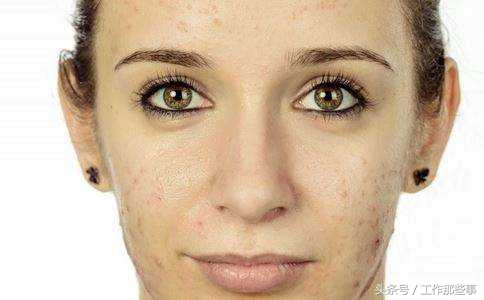 生姜5种搭配治百病,生姜是保健良方吗