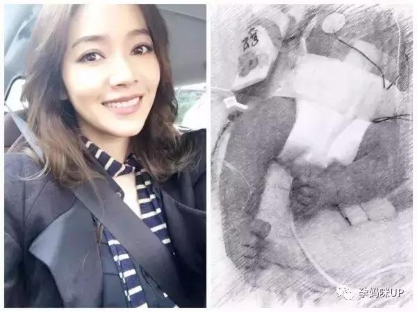 侯佩岑小儿子溶血症好了吗,侯佩岑孩子溶血症