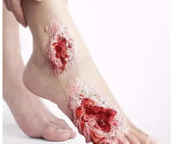 泰国防糖广告,新加坡防糖广告视频