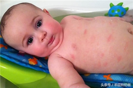 吃火龙果过敏吃猕猴桃会过敏吗,以前吃猕猴桃不过敏现在过敏了