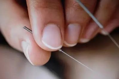 刘红云针灸退化性膝关节炎,膝关节炎的董氏针灸疗法