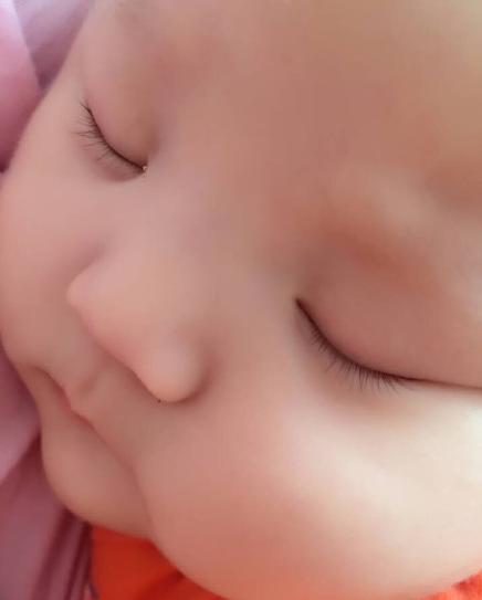 妊娠糖尿病顺产巨大儿,妊娠糖尿病孕妇顺产容易大出血吗