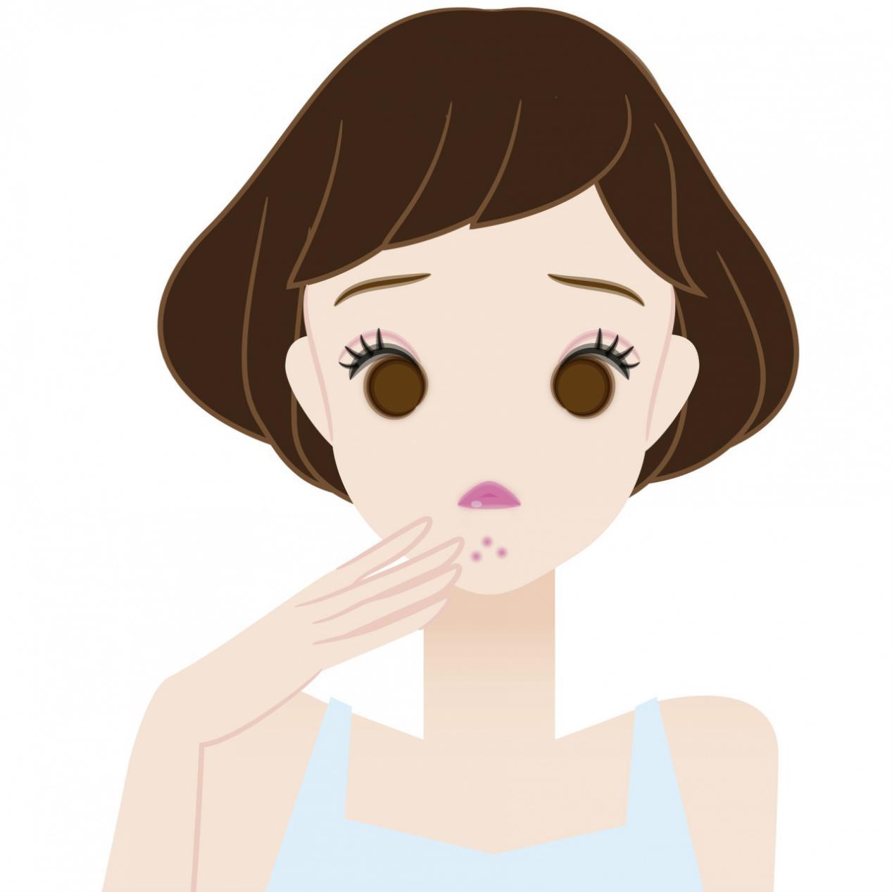 额头两颊长痘痘是什么原因,额头两颊长痘是什么原因