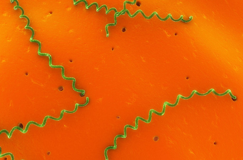 瀹犵墿鍠濅笉骞插噣鐨勬按鐢熺梾,瀹犵墿涔辨媺灞庡翱鎬庝箞瑙ｅ喅