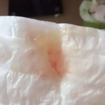 生宝宝先见红和先破羊水的区别,生孩子先破水还是先见红有讲究