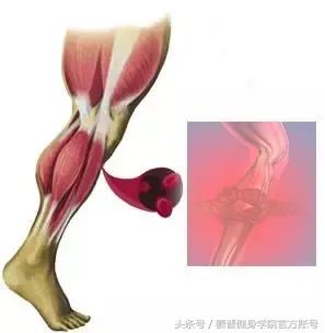 运动时肌肉拉伤的预防方法,运动时肌肉拉伤怎样处理