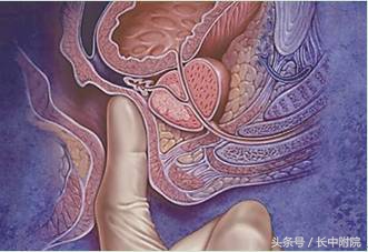 男人到了30岁还有病吗,男人得了这三种病