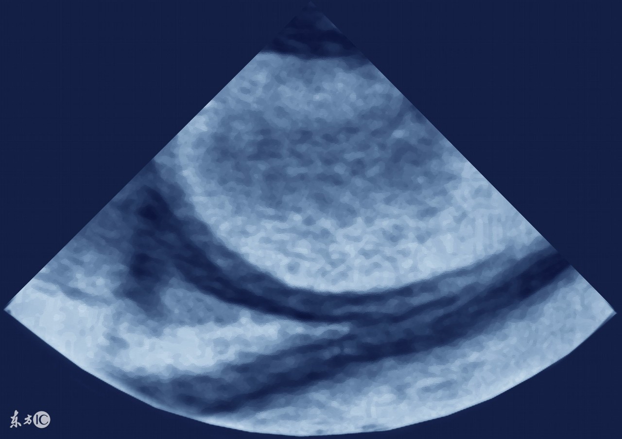 什么样的癌症肚子里有水,哪些病会导致肚子腹水