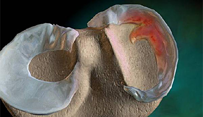 腿软啥问题,腿软无力是大病前兆