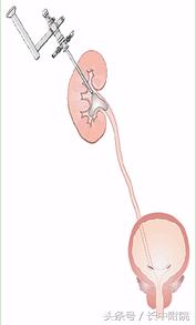 男人到了30岁还有病吗,男人得了这三种病