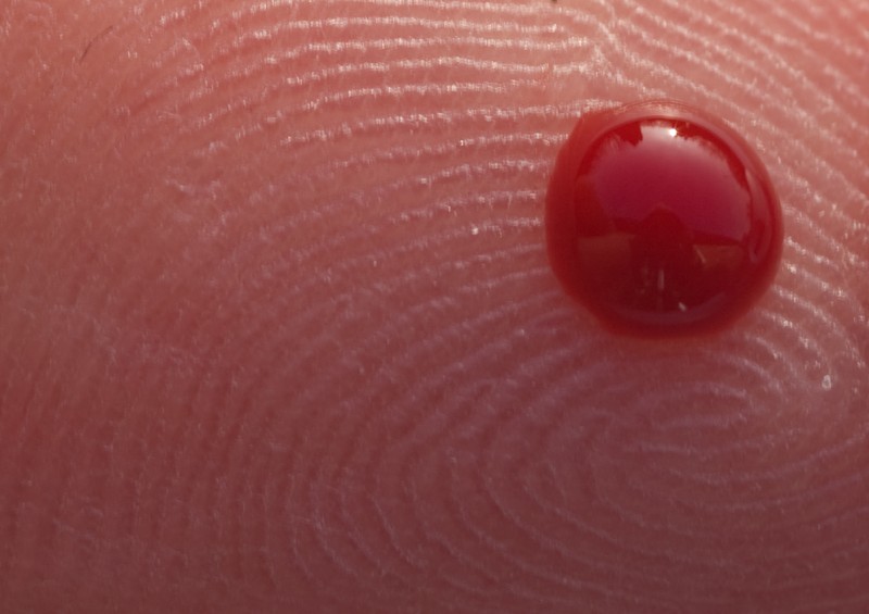 脖子后面有黑色纹路怎么回事,脖子上的纹路像脏的一样怎么回事