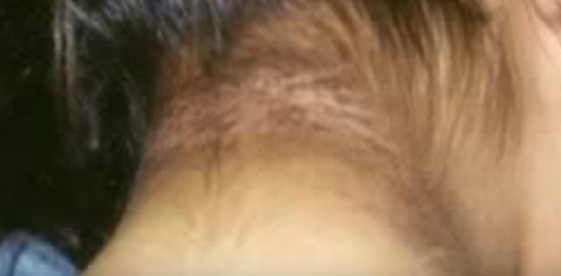 脖子后面有黑色纹路怎么回事,脖子上的纹路像脏的一样怎么回事