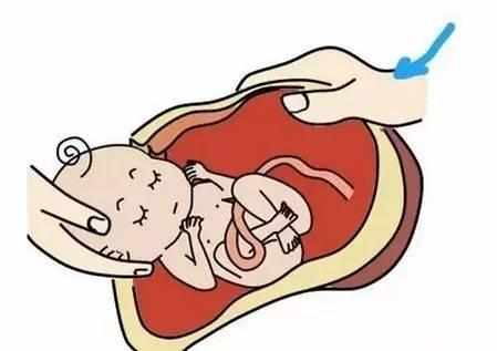 剖腹产麻醉对身体副作用,剖腹产麻醉对身体的危害