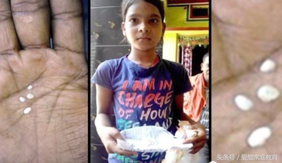 7岁眼睛流粘泪是什么原因,11岁女孩经常流鼻涕