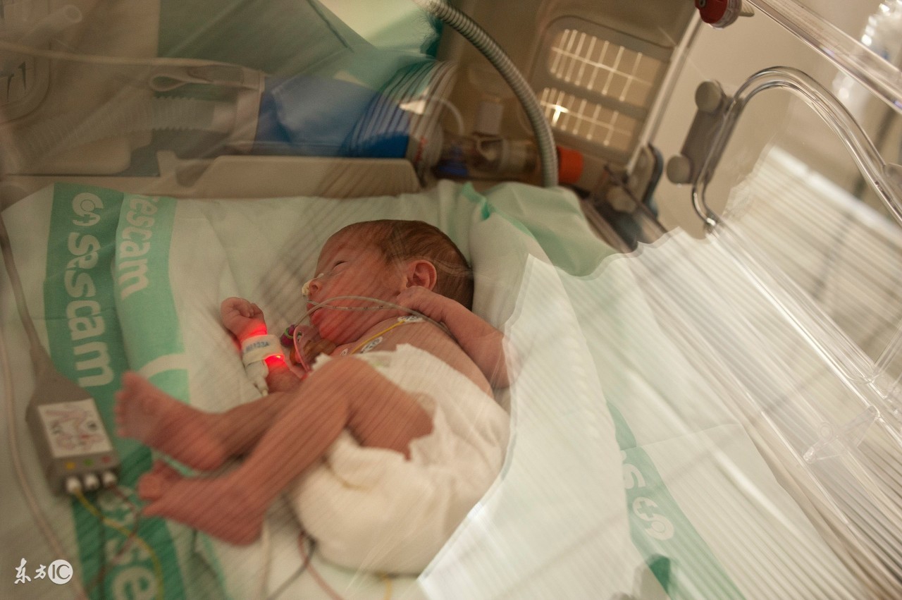 34周早产需要关注什么,早产的宝妈应该关注哪些