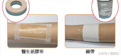 医美祛疤方法,医美祛色素疤痕