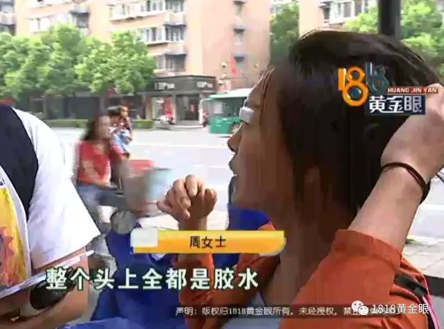 割完双眼皮，头发被胶水粘住！看监控，发现同行的闺蜜有可疑动作