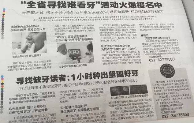 牙齿太丑了换牙怎么办,不整牙怎么把牙齿变整齐