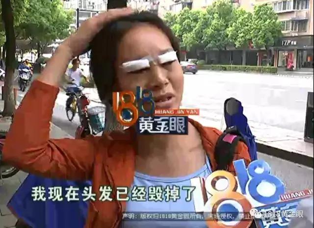 割完双眼皮，头发被胶水粘住！看监控，发现同行的闺蜜有可疑动作