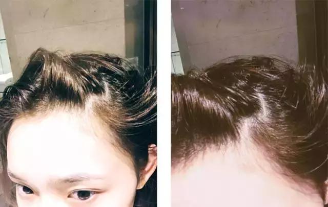 林允卸妆喝美白饮视频,林允推荐卸妆