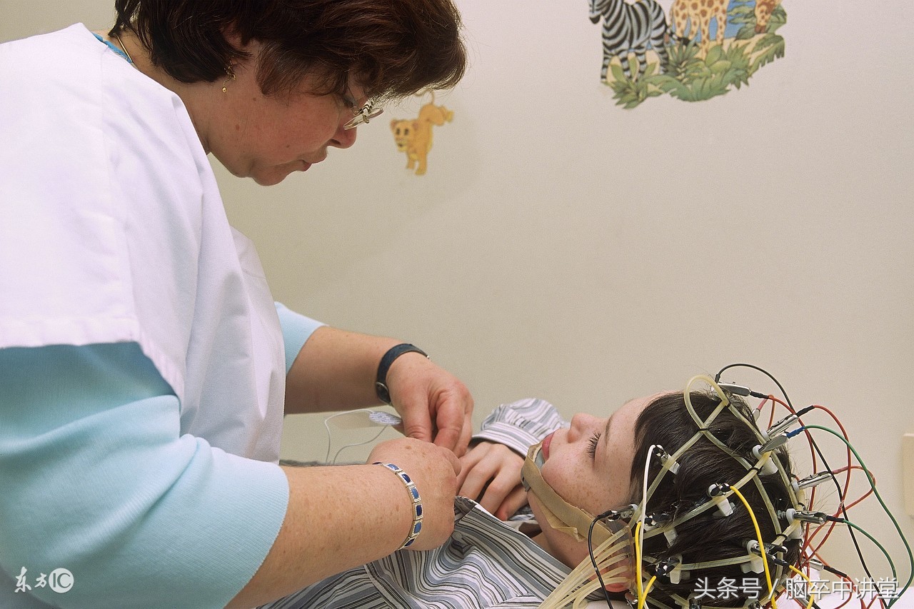 卒中后癫痫首选用药有哪些,卒中后癫痫