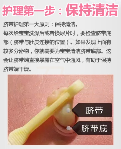 宝宝脐带发炎消毒视频,宝宝的脐带怎样护理到正常脱落