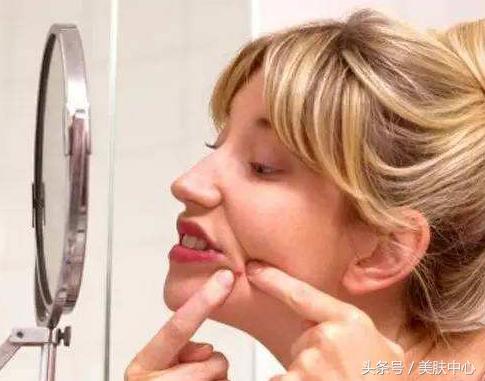 长期下巴痘痘去除小妙招,去下巴痘痘小妙招小学生