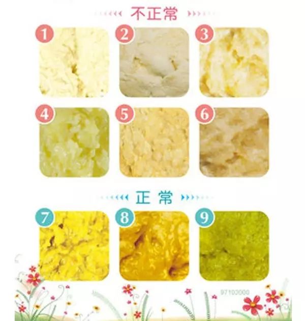 bb打完疫苗关注事项,宝妈刚生完宝宝关注事项