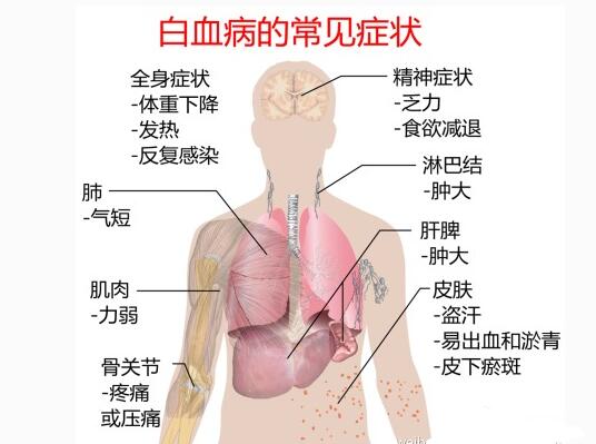 白血病新药研究成功了吗,白血病化疗新药