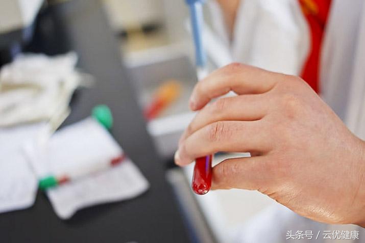 你的肝脏好不好,通过肝功能检查能知道肝的好坏吗