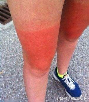 骑行受伤的十大技巧,骑行时发生事故后的做法是正确的