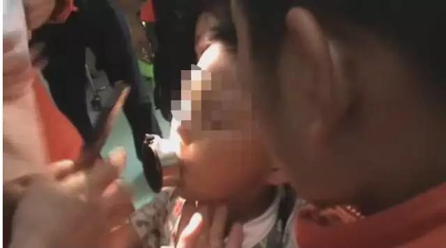 6岁宝宝喝水，不慎将舌头卡住瓶盖至血肿僵硬