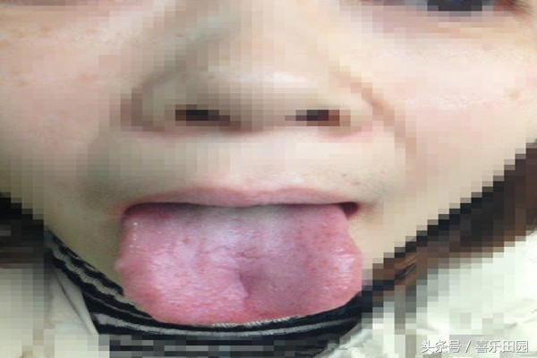 女性湿气重的6大征兆,湿气重的女性常有3个表现