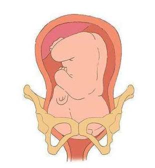 孕晚期“肚子痛”代表要生了？孕晚期腹痛的原因有哪些？