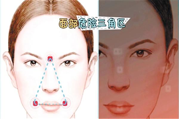 一颗痘引发的惨案,50岁大叔突发心梗命悬一线