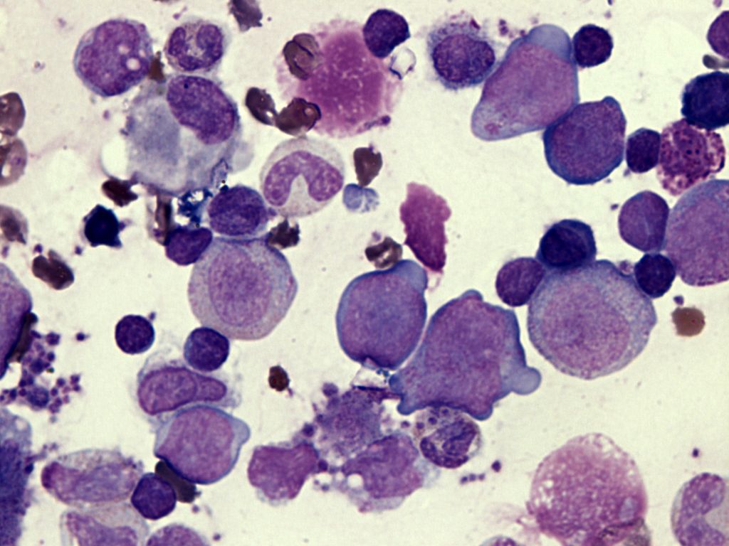 探秘轻断食的减脂成分四绿咖啡,轻断食台湾酵素粉