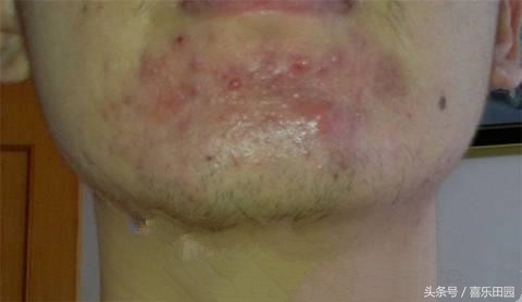 女性湿气重的6大征兆,湿气重的女性常有3个表现