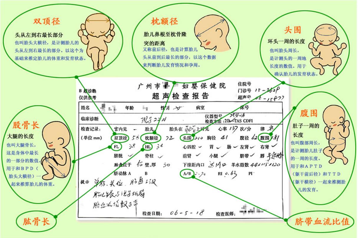 刚怀孕20天的抽血检查报告单,孕妈必须要看懂的孕检报告