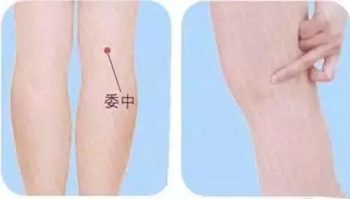 拔罐都是水泡怎么回事,身上湿气重拔罐有水泡