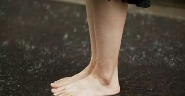 拔罐都是水泡怎么回事,身上湿气重拔罐有水泡