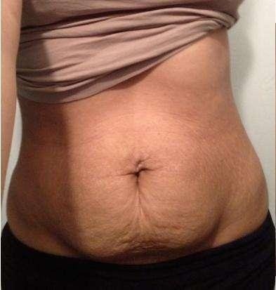 灏忔煚鍏荤敓閿荤偧,灏忔煚淇濆吇