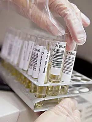 一招看懂尿常规,30秒教你看懂尿常规