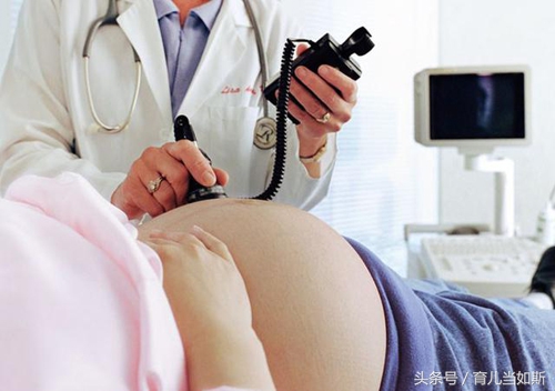 完全性前置胎盘的亲身经历,完全性前置胎盘的生产经历