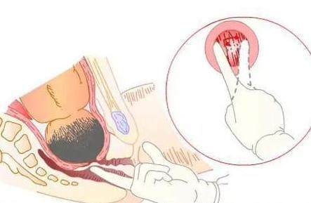 产前最让人崩溃的检查，产妇欲哭无泪，医生哭笑不得，简直了
