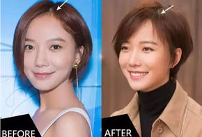 拯救大额头高发际线学王珞丹微风刘海超短发就搞定了