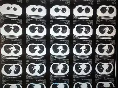 为啥医生让我做核磁，让他做CT？X光、CT、核磁到底有啥区别？