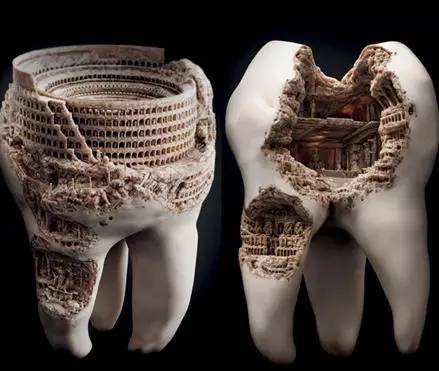 蛀牙只剩牙根不管会怎么样,牙齿蛀牙黑了不治疗多久会痛