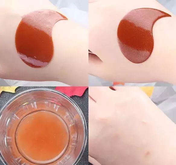 眼周细纹形成的原因,眼周出现细纹怎样消除