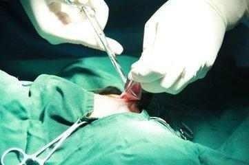 生完孩子上环一年后去取环,妇科上环7年了取了环会怀孕吗